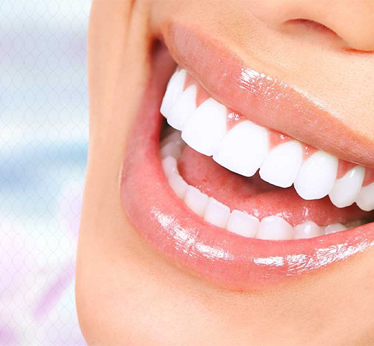 ابتسامة هوليوود اربد ابتسامة هوليوود اربد