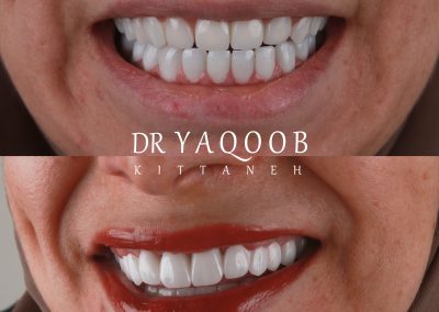 احسن دكتور اسنان اربد